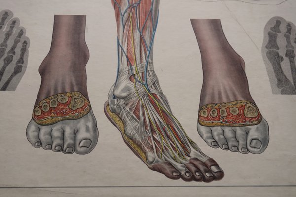 Anatomical Foot Chart