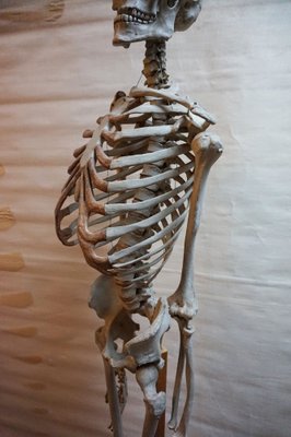 Modèle Squelette Anatomique Médical Didactique Vintage, Allemagne