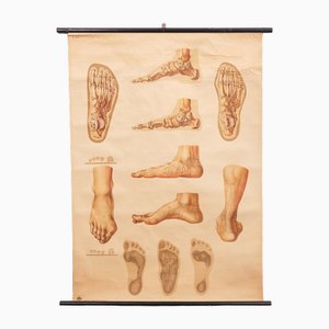 Vintage Pull-Down Medical Wall Chart Illustrating Orthopedics of Foot, 1935