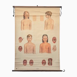 Vintage Training Poster with Childhood Illnesses, 1930-1940