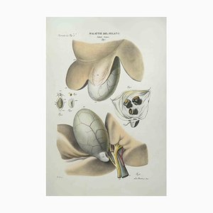 Ottavio Muzzi, Liver Disease, Lithograph, 1843