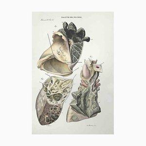 Ottavio Muzzi, Lung Diseases, Lithograph, 1843