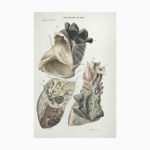 Ottavio Muzzi, Diseases of the Brain, Lithograph, 1843