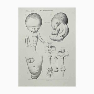 Ottavio Muzzi, Conformation Defects, Lithograph, 1843