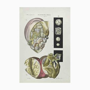 Ottavio Muzzi, Diseases of the Spleen, Lithograph, 1843