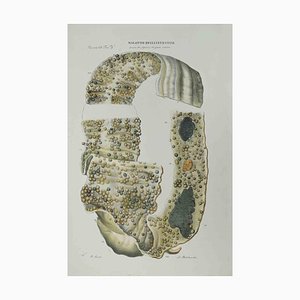 Ottavio Muzzi, Darmerkrankungen, Lithographie, 1843