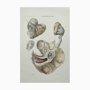 Ottavio Muzzi, Diseases of the Uterus, Lithograph, 1843