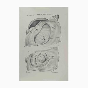 Ottavio Muzzi, Stomach Diseases, Lithograph, 1843