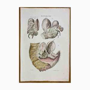 Ottavio Muzzi, Diseases of Uterus, Lithograph, 1843