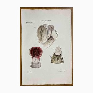 Ottavio Muzzi, Diseases of Uterus, Lithograph, 1843
