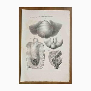 Ottavio Muzzi, Intestinal Diseases, Lithograph, 1843