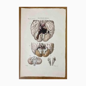 Ottavio Muzzi, Brain Diseases, Lithograph, 1843