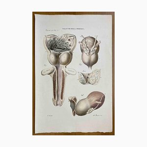 Ottavio Muzzi, Prostate Diseases, Lithograph, 1843