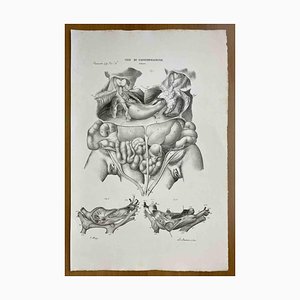 Ottavio Muzzi, Conformation Defects, Lithograph, 1843