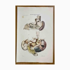 Ottavio Muzzi, Stomach Diseases, Lithograph, 1843