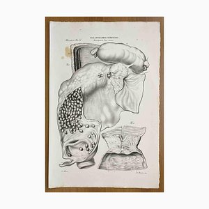 Ottavio Muzzi, Intestinal Diseases, Lithograph, 1843