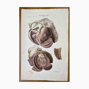 Ottavio Muzzi, Heart Diseases, Lithograph, 1843