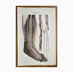 Ottavio Muzzi, Diseases of the Arteries, Lithograph, 1843