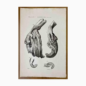 Ottavio Muzzi, Skin Diseases, Lithograph, 1843