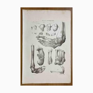 Ottavio Muzzi, Défauts de Conformation, Lithographie, 1843