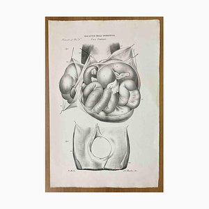 Ottavio Muzzi, Intestinal Diseases, Lithograph, 1843