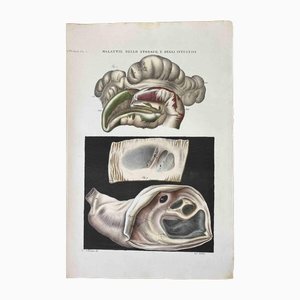 Ottavio Muzzi, Diseases of the Stomach and Intestines, Lithograph, 1843