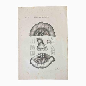 Ottavio Muzzi, Enfermedades de los vasos linfáticos, Litografía, 1843