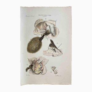 Ottavio Muzzi, Maladies de l'ovaire, Lithographie, 1843