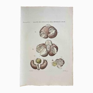 Ottavio Muzzi, Diseases of the Cerebellum, Lithograph, 1843
