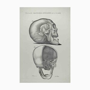 Ottavio Muzzi, Joint Diseases, Lithograph, 1843