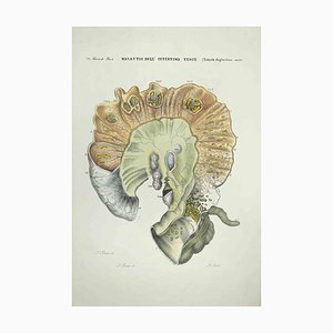 Ottavio Muzzi, Enfermedades del intestino delgado, litografía, 1843