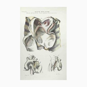 Ottavio Muzzi, Stomach Diseases, Lithograph, 1843
