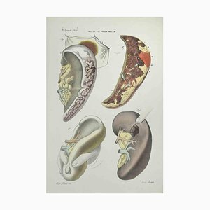 Ottavio Muzzi, Liver Diseases, Lithograph, 1843