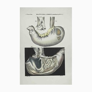 Ottavio Muzzi, Stomach Diseases, Lithograph, 1843