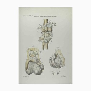 Ottavio Muzzi, Joint Diseases, Lithograph, 1843