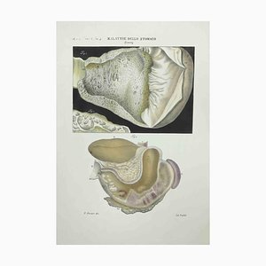 Ottavio Muzzi, Stomach Diseases, Lithograph, 1843
