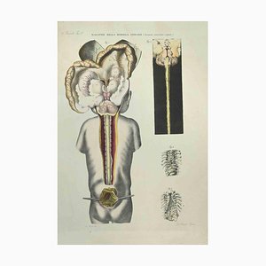 Ottavio Muzzi, Spinal Cord Diseases, Lithograph, 1843