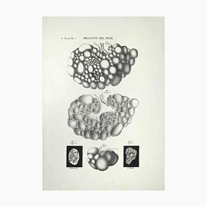 Ottavio Muzzi, Kidney Diseases, Lithograph, 1843