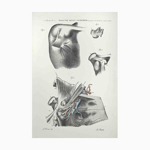 Ottavio Muzzi, Diseases of the Extremities, Lithograph, 1843