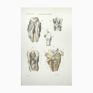 Ottavio Muzzi, Krankheiten der Laringe, Lithographie, 1843