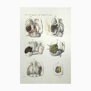 Ottavio Muzzi, Brain Diseases, Lithograph, 1843