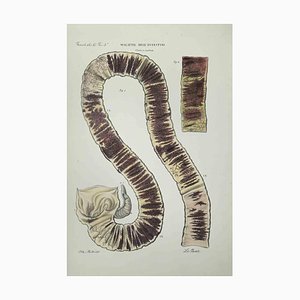 Ottavio Muzzi, Bowel Diseases, Lithograph, 1843