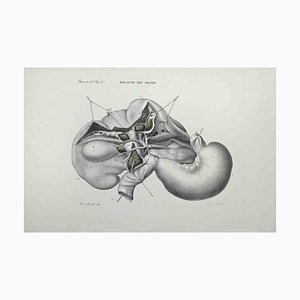 Ottavio Muzzi, Liver Disease, Lithograph, 1843