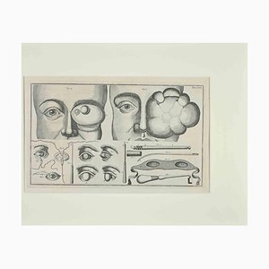 Lorenz Heister, Surgery of the Eye, Etching, 1750