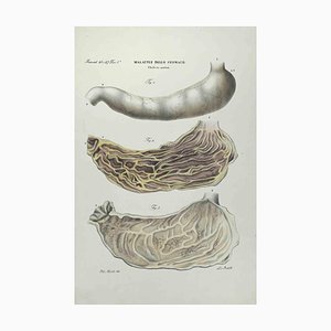 Ottavio Muzzi, Stomach Diseases, Lithograph, 1843