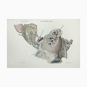 Ottavio Muzzi, Uterus Diseases, Lithograph, 1843