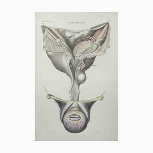Ottavio Muzzi, Uterus Diseases, Lithograph, 1843