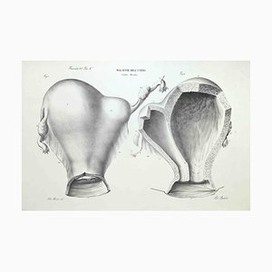 Ottavio Muzzi, Uterus Diseases, Lithograph, 1843