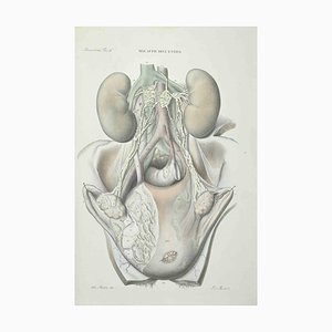 Ottavio Muzzi, Uterus Diseases, Lithograph, 1843