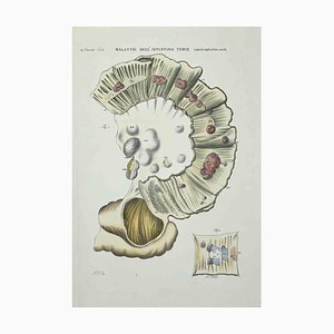Ottavio Muzzi, Small Intestine Diseases, Lithograph, 1843